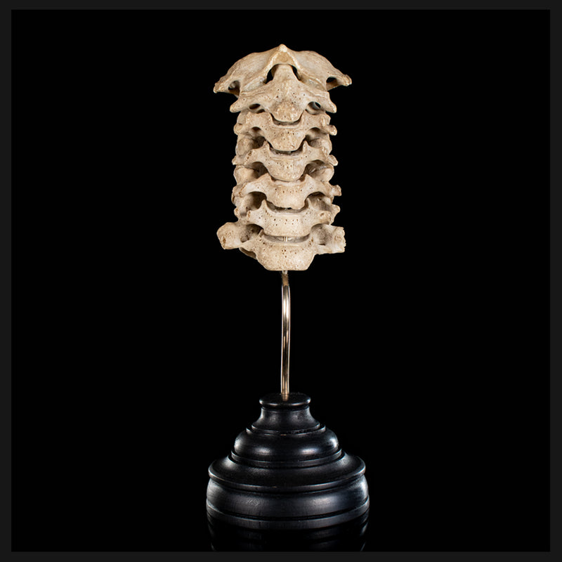 Real Human spine C1 to C7