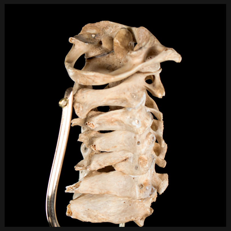 Real Human spine C1 to C7