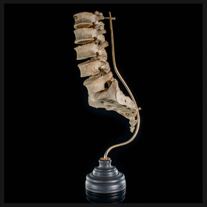 Real Human spine L1 to L5 and sacrum
