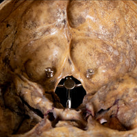 Real human skull and crossbones