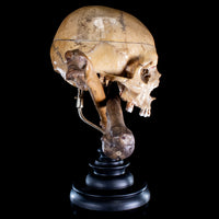Real human skull and crossbones