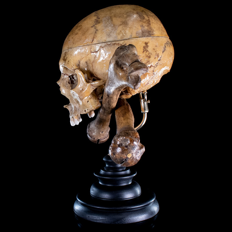 Real human skull and crossbones