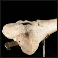 Tibia & fibula on base