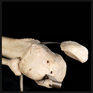Tibia & fibula on base