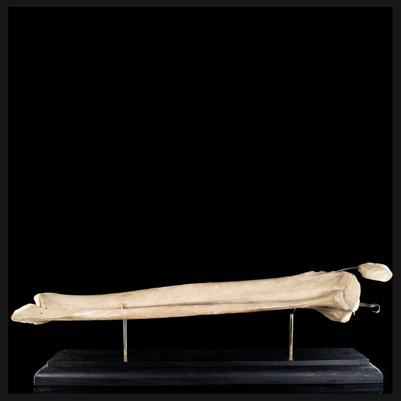 Tibia & fibula on base