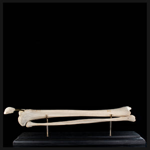 Tibia & fibula on base