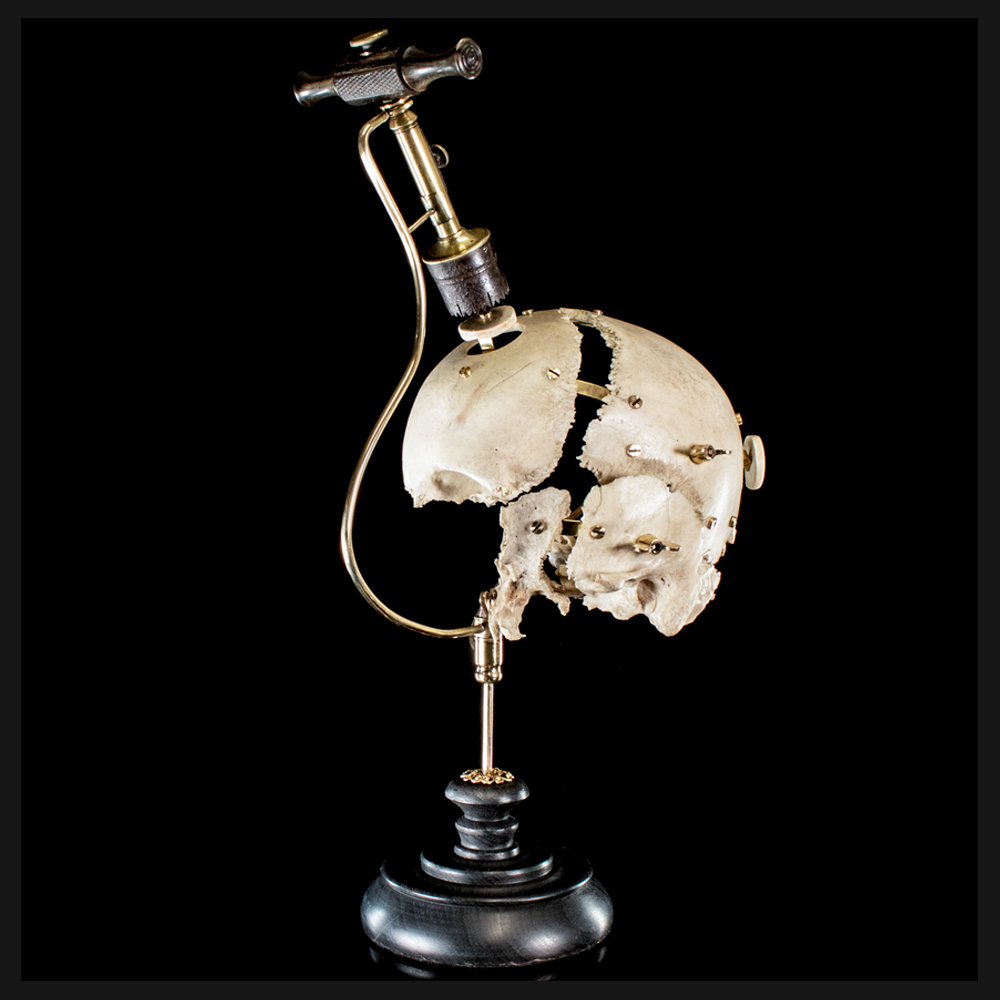 Skull Rreal Real human skulls for sale, By Mattaeus Ball