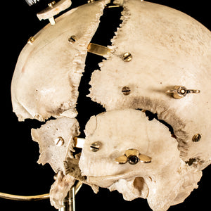 Real human skull, trepidation, vintage trephine,