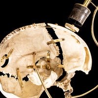 Real human skull, trepidation, vintage trephine,