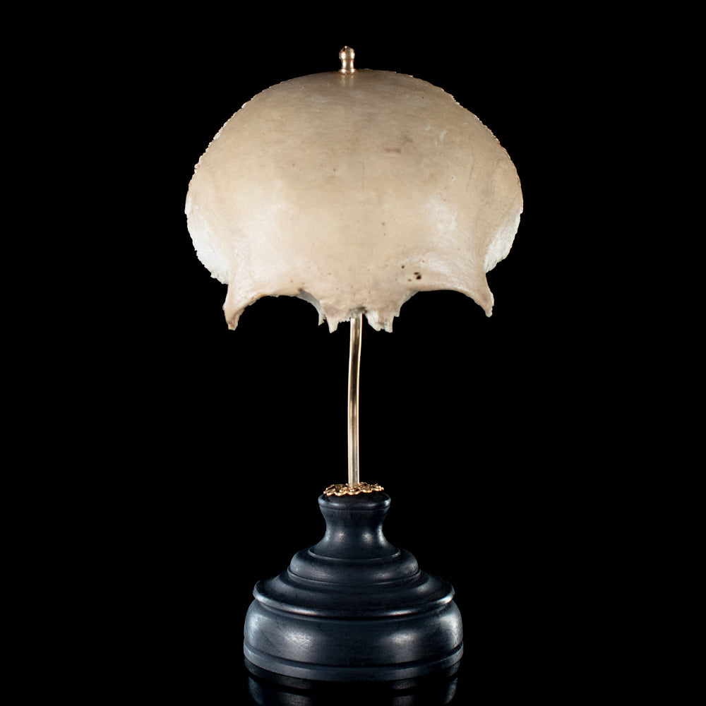 Real human frontal bone on bespoke base