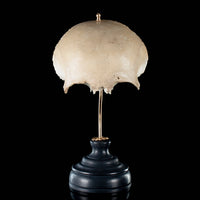 Real human frontal bone on bespoke base