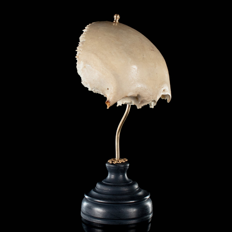 Real human frontal bone on bespoke base