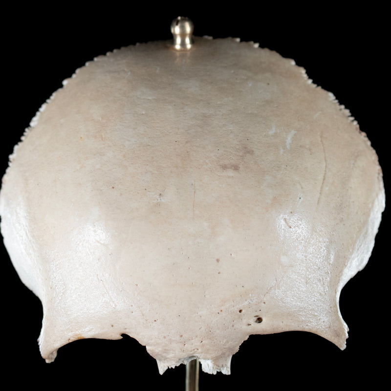 Real human frontal bone on bespoke base