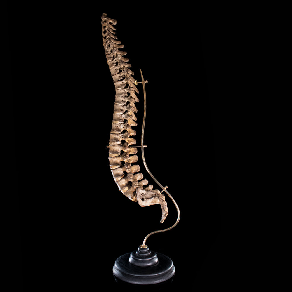 Human Realspine Real human Bones for sale, including real skull and crossbones ...