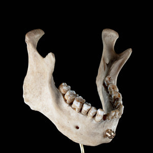 Real human jaw bone on bespoke base