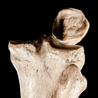 Human tibia fibula on custom base