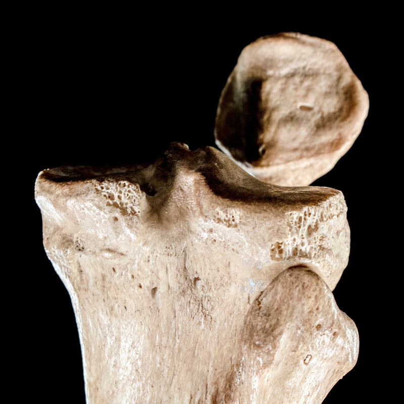 Human tibia fibula on custom base