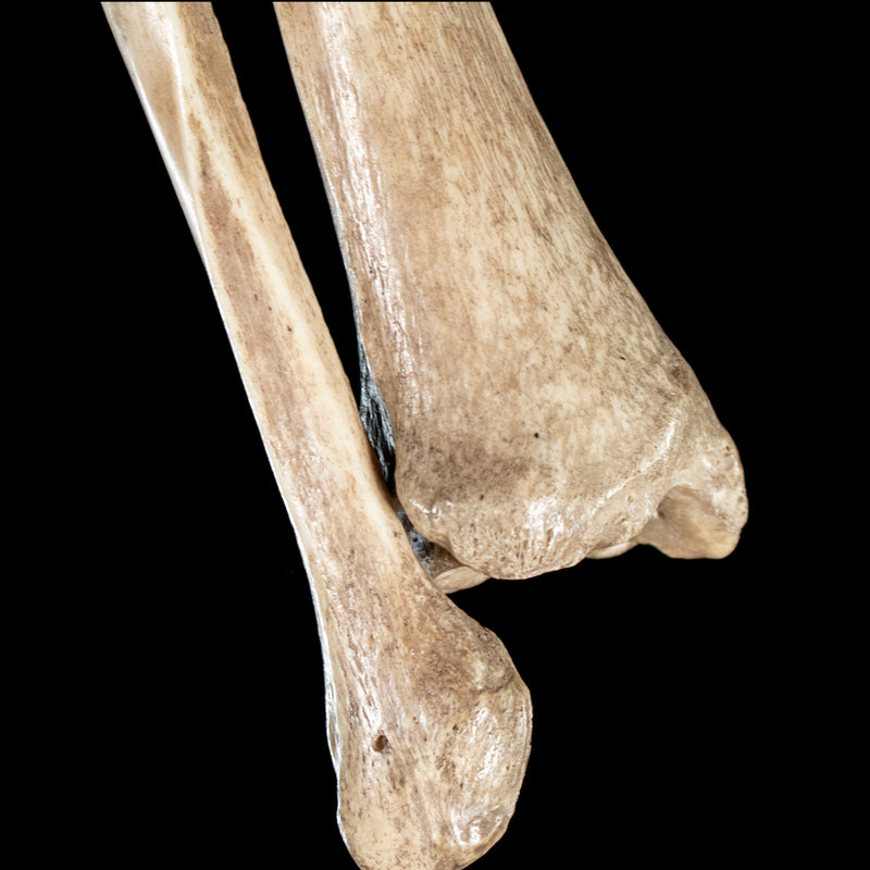 Human tibia fibula on custom base
