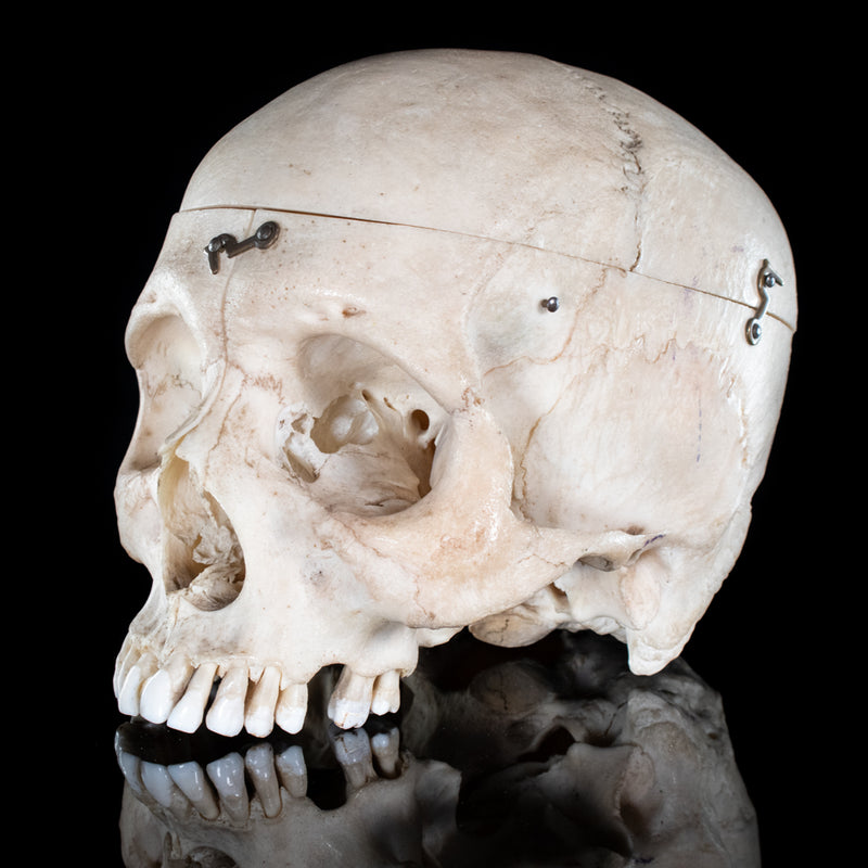 Human skull with a vertical cut