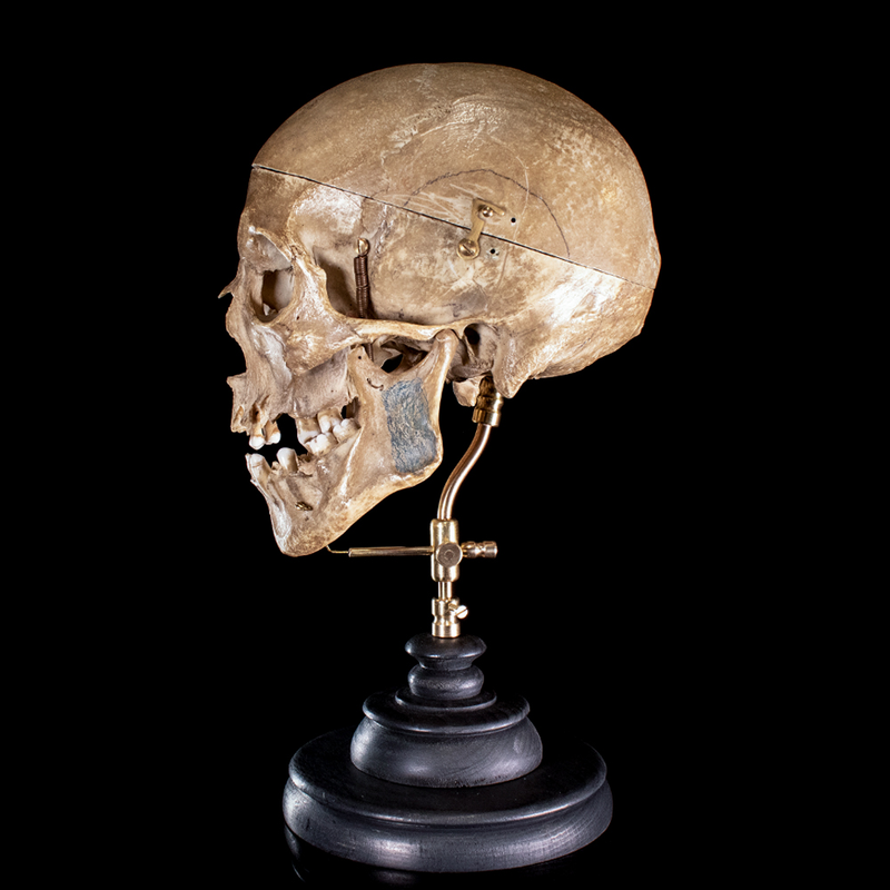 Human skull with moving mouth articulation