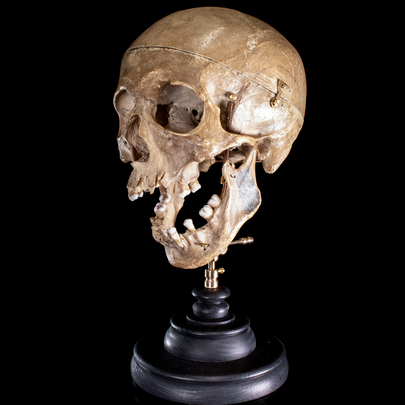 Human skull with moving mouth articulation
