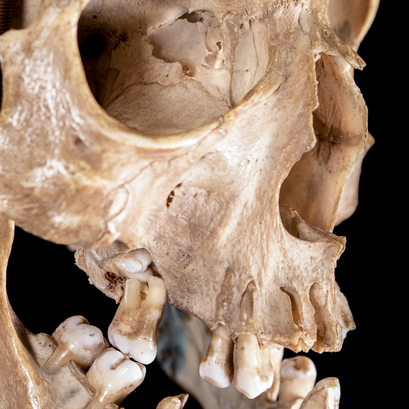 Human skull with moving mouth articulation