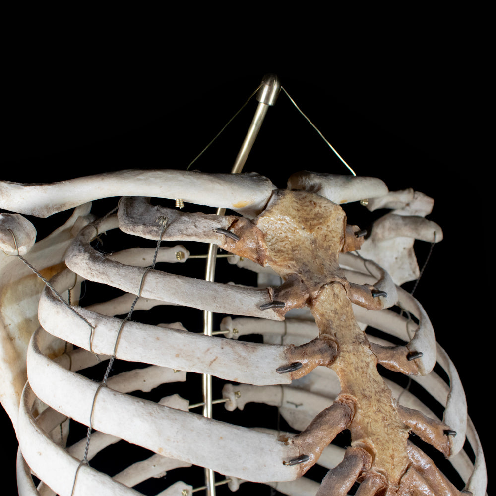 Real rib cage – Mattaeus Ball