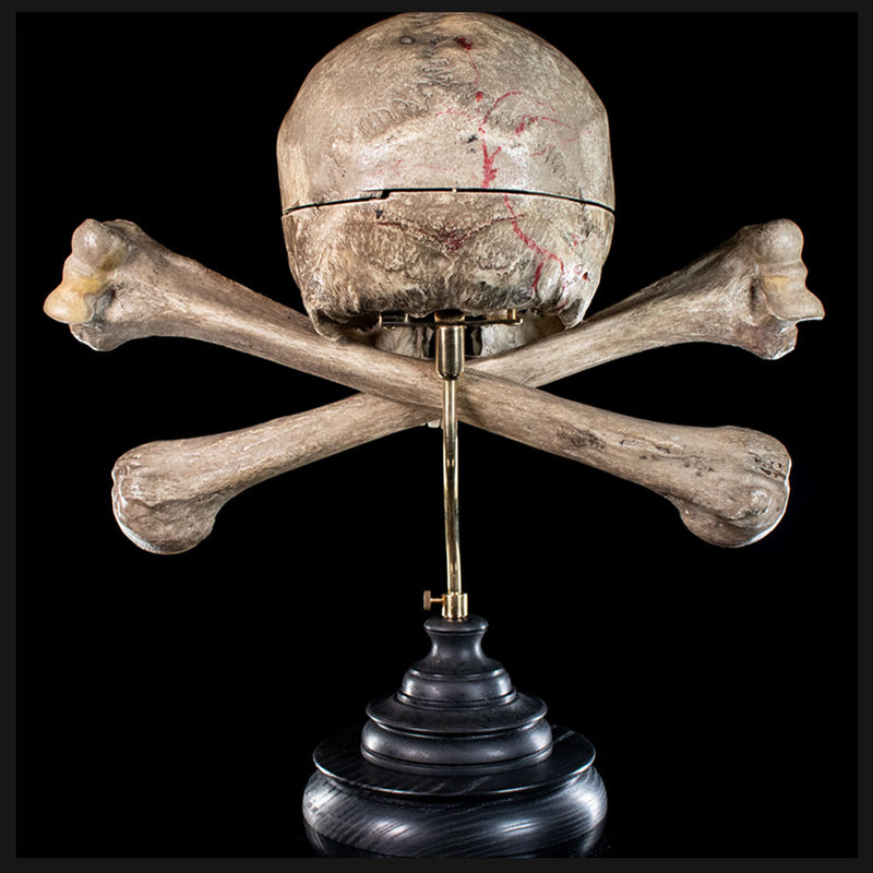 Real human skull and crossbones for sale – Mattaeus Ball