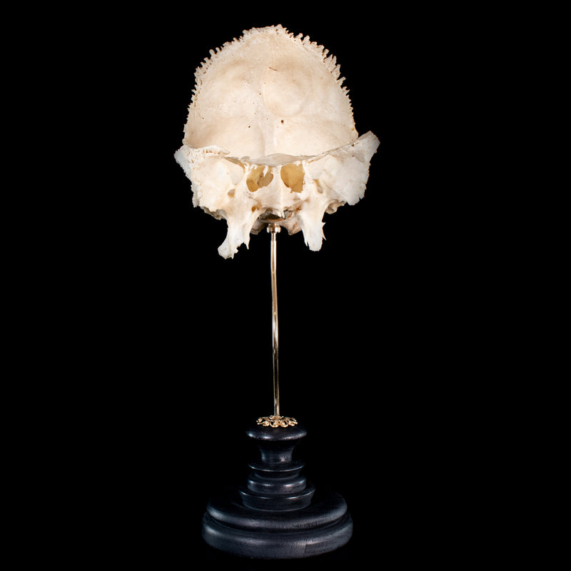 Real human skull, Beauchene preparation