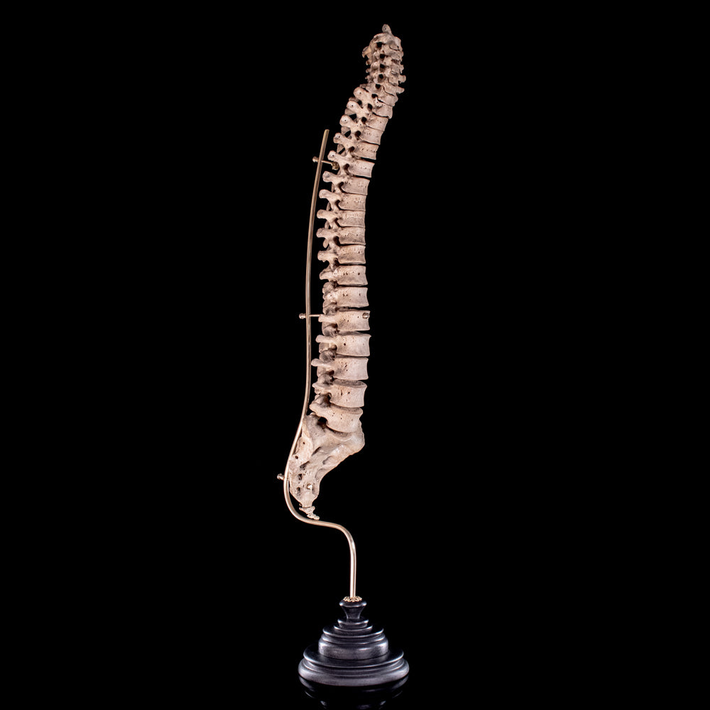 Human Realspine Mattaeus Ball: Unique and ethically sourced human bone sculpture