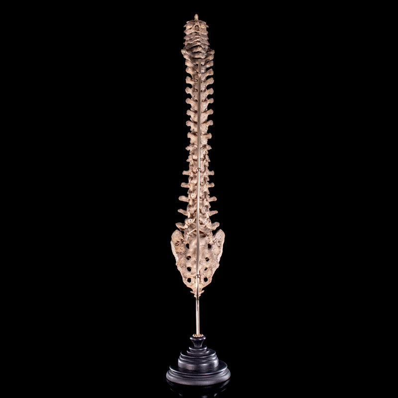 Real Human spine