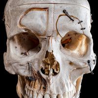 Human skull with a vertical cut and cut outs