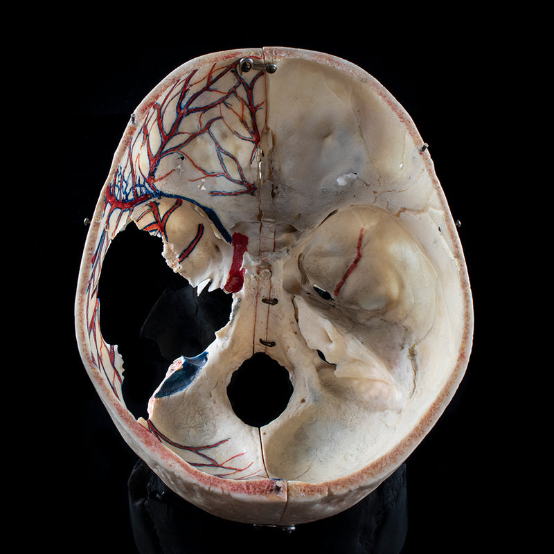 Human skull with a vertical cut and cut outs