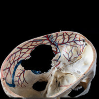 Human skull with a vertical cut and cut outs