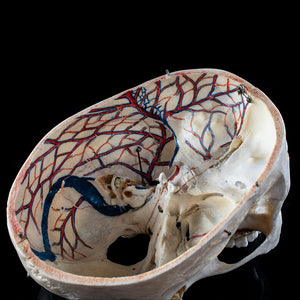 Human skull with a vertical cut and cut outs