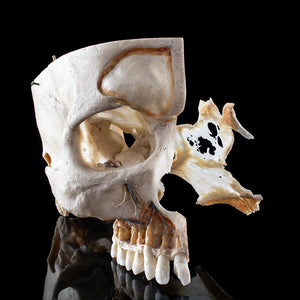 Human skull with a vertical cut and cut outs