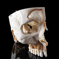 Human skull with a vertical cut and cut outs