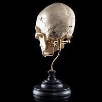 Human skull with a vertical cut and cut outs